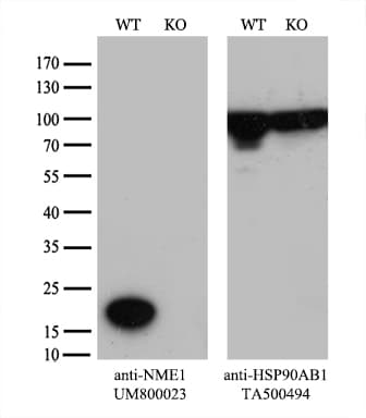 Monoclonal Mouse anti-Human NME1 / NM23 Antibody (clone UMAB92, IHC, IF, WB)