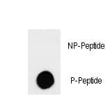 Polyclonal Rabbit anti-Human Tuberin / TSC2 Antibody (phospho-Ser664, IF)