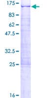 Human DDX21 Protein (Recombinant GST)