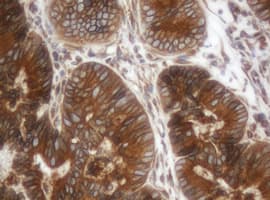 ILVBL Antibody (clone OTI3E9)