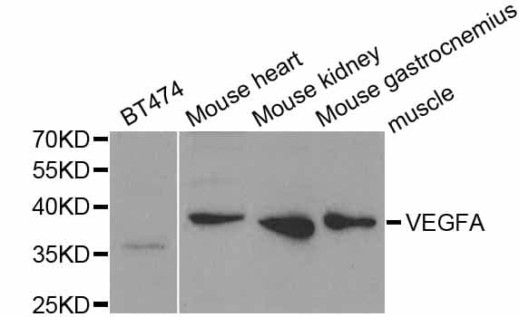 VEGFA / VEGF Antibody