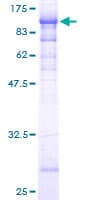 Human BFSP1 / Filensin Protein (Recombinant GST)