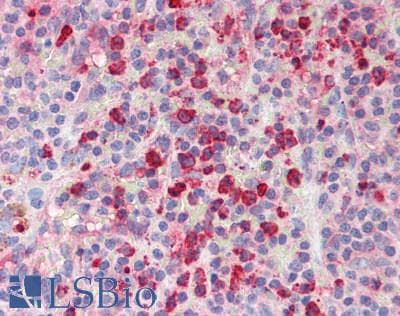 IHC-plus™ LL37 / Cathelicidin Antibody