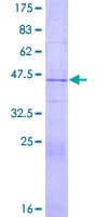 Human RAXL1 / RAX2 Protein (Recombinant GST)