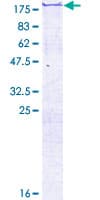 Human FSCB Protein (Recombinant GST)