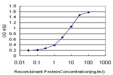 IHC-plus™ STAT5B Antibody (clone 2D1)