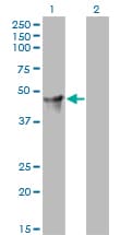 CYTH2 / Cytohesin 2 Antibody (clone 6H5)