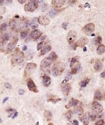 PINK1 Antibody (aa350-500, DY650)