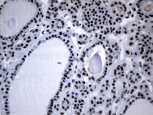 Monoclonal Mouse anti-Human POLR2A / RNA polymerase II Antibody (clone OTI3C8, aa1351-1614, IHC, WB)