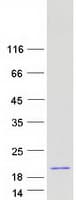 Human HBE1 / Hemoglobin Epsilon 1 Protein (Recombinant Myc-DDK (Flag))