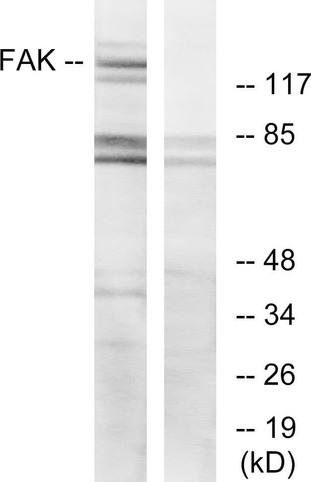 FAK / Focal Adhesion Kinase Antibody (aa892-941)