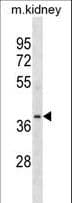 POC1A / SOFT Antibody (aa34-61)