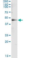 Monoclonal Mouse anti-Human HDAC8 Antibody (clone 2F4, WB)
