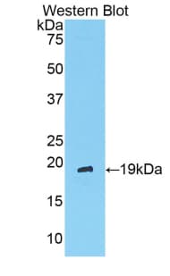 ANGPT1 / Angiopoietin-1 Antibody (aa304-450)
