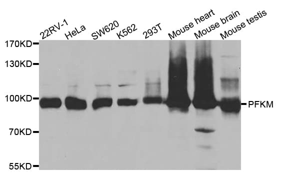 PFKM / PFK-1 Antibody