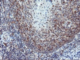 PYCARD / ASC / TMS1 Antibody (clone OTI2A7)