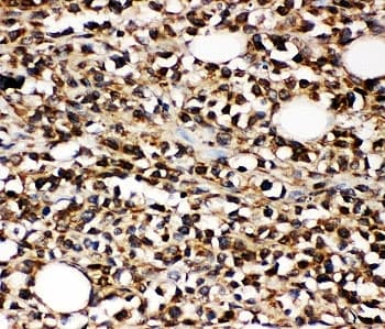 Polyclonal Rabbit anti-Human MME / CD10 Antibody (aa52-750, IHC, WB)