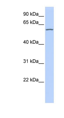 Polyclonal Rabbit anti-Human RBPJL Antibody (aa360-409, WB)