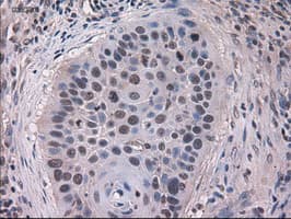 KRT18 / CK18 / Cytokeratin 18 Antibody (clone OTI5E8)