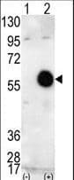 Polyclonal Rabbit anti-Human AKT2 Antibody (aa416-444, IHC, IF, WB)