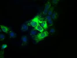 TS / Thromboxane Synthase Antibody (clone OTI1C3)