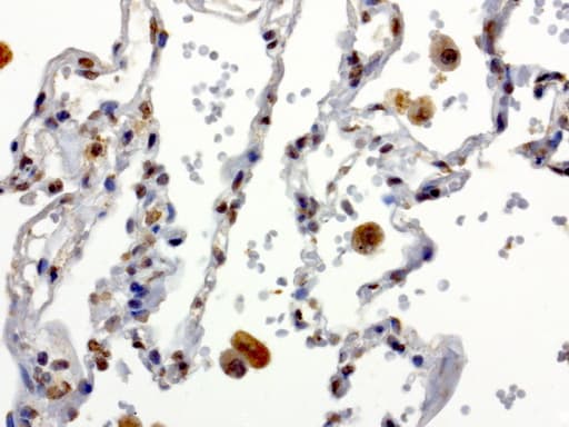 XRCC1 Antibody (clone UMAB40, Carrier-free)