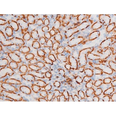 MAPK8 / JNK1 Antibody (phospho-Thr183)