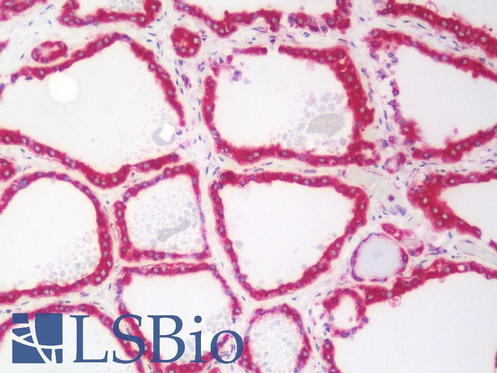 GANAB / Alpha Glucosidase II Antibody (aa47-251)