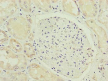 Polyclonal Rabbit anti-Human HOOK2 Antibody (IHC, WB)