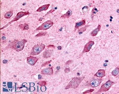 PathPlus™ TAOK1 / TAO1 Antibody (Internal)