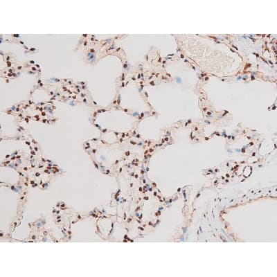 Polyclonal Rabbit anti-Human RELA / NFKB p65 Antibody (phospho-Thr435, IHC, IF, WB)