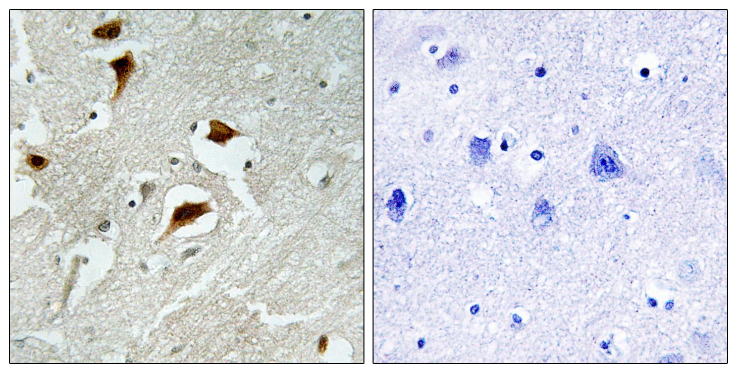 EIF4EBP1 / 4EBP1 Antibody (phospho-Thr69)