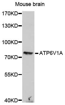 ATP6V1A1 / ATP6V1A Antibody