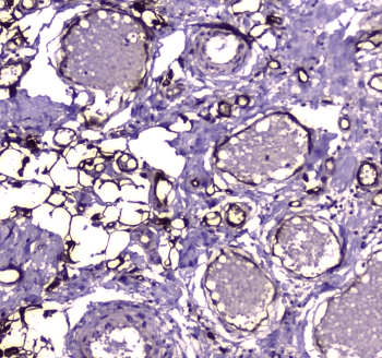 Polyclonal Rabbit anti-Human E-FABP / FABP5 Antibody (IHC, WB)