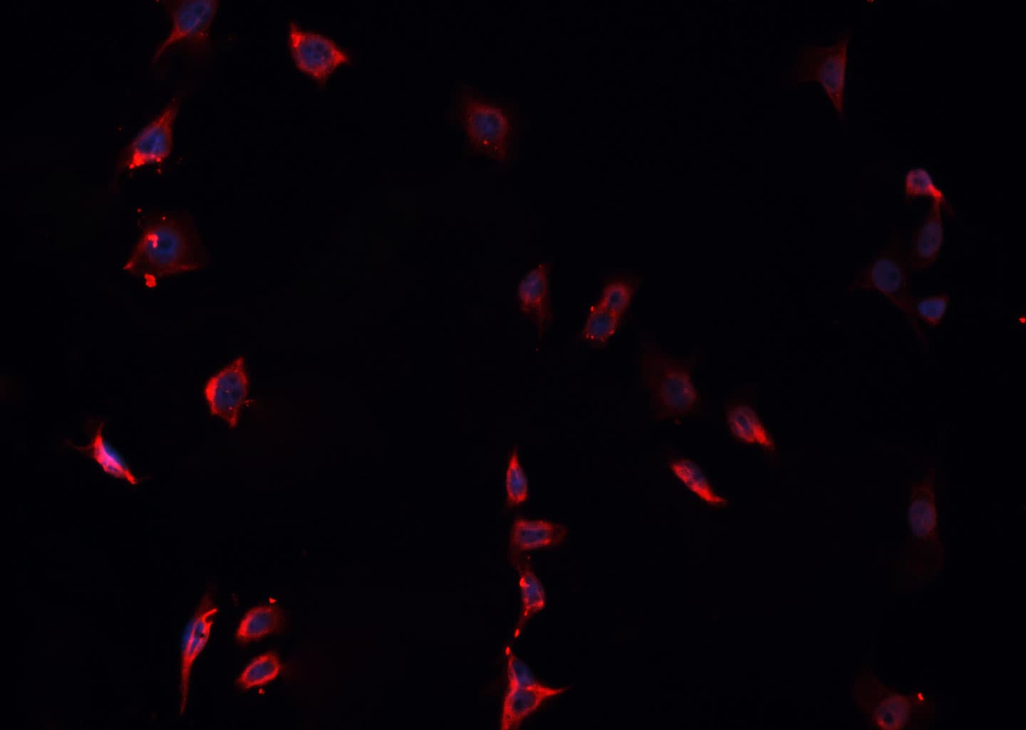 LGALS9 / Galectin 9 Antibody
