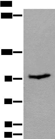 Polyclonal Rabbit anti-Human UNC45B Antibody (WB)