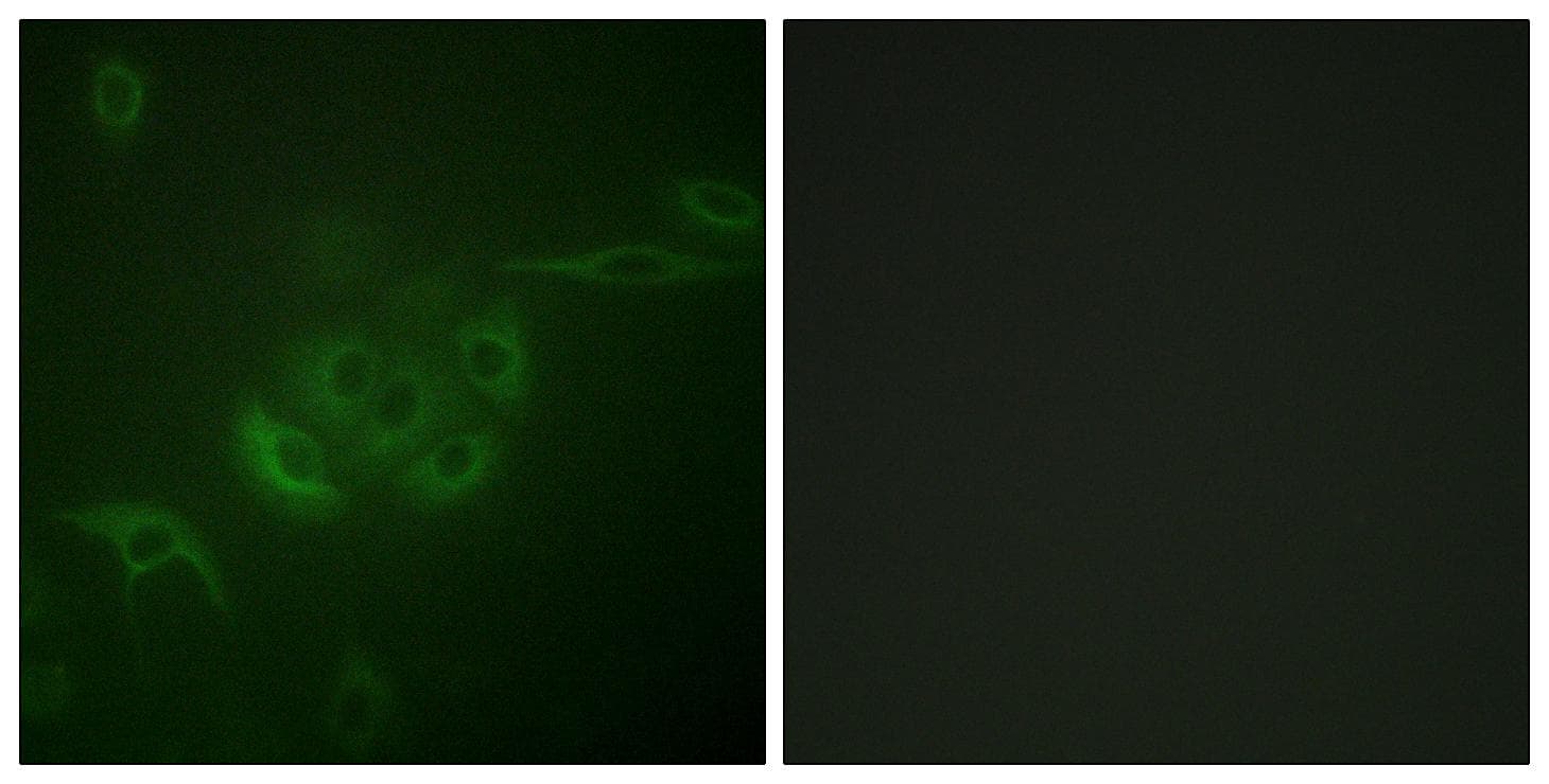 MAP2K4 / MKK4 Antibody