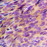 Polyclonal Rabbit anti-Human PDE4B+C+D Antibody (Internal, IHC, WB)