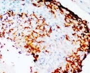 PTGS2 / COX2 / COX-2 Antibody (N-Terminus, Sepharose)