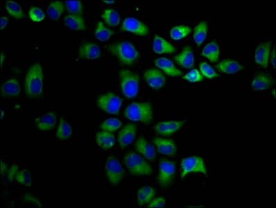 PKD1 / Polycystin Antibody