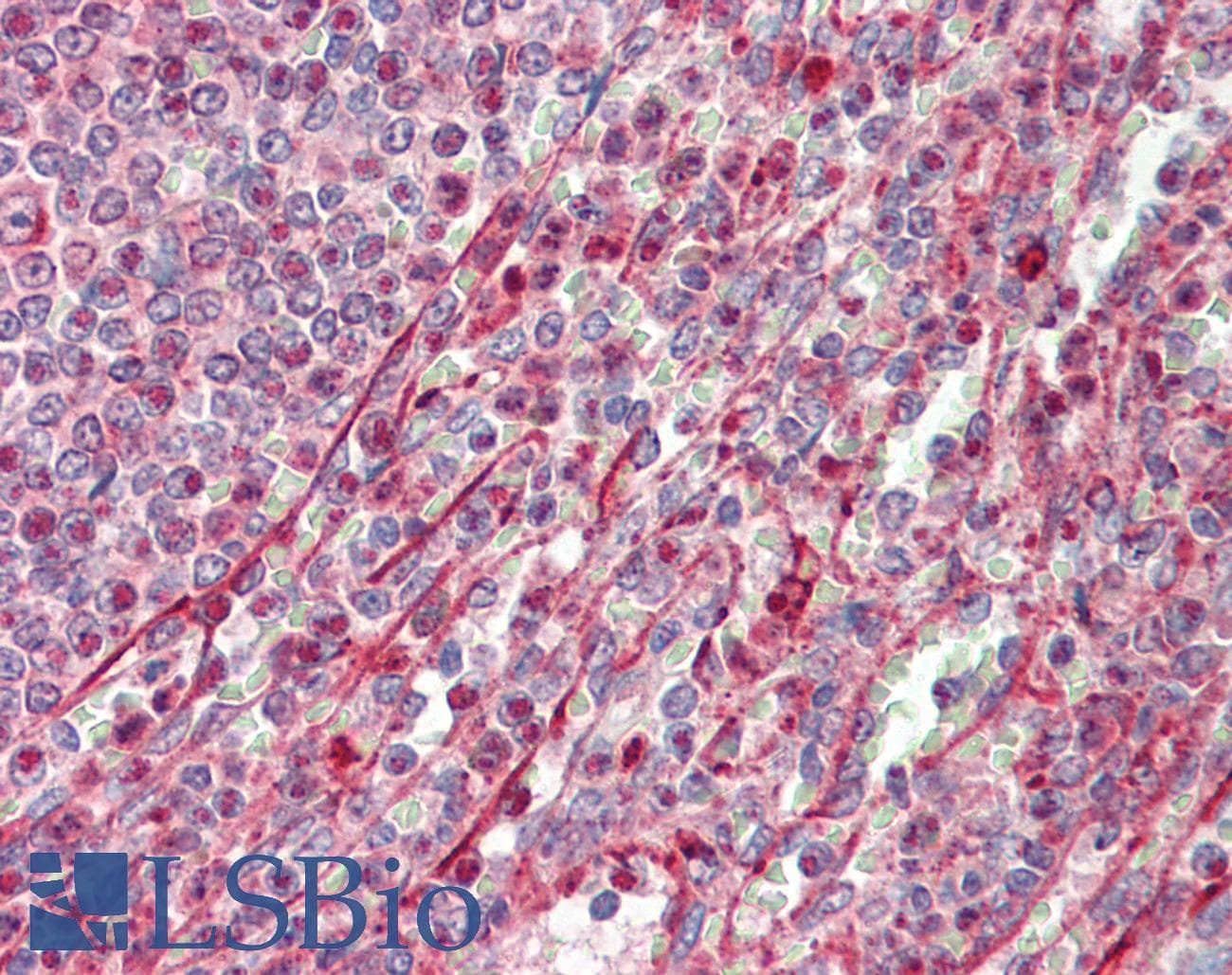 IHC-plus™ EEF2K Antibody (aa336-385)