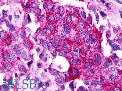 PathPlus™ Polyclonal Rabbit anti-Human S1PR1 / EDG1 / S1P1 Antibody (Cytoplasmic Domain, IHC)