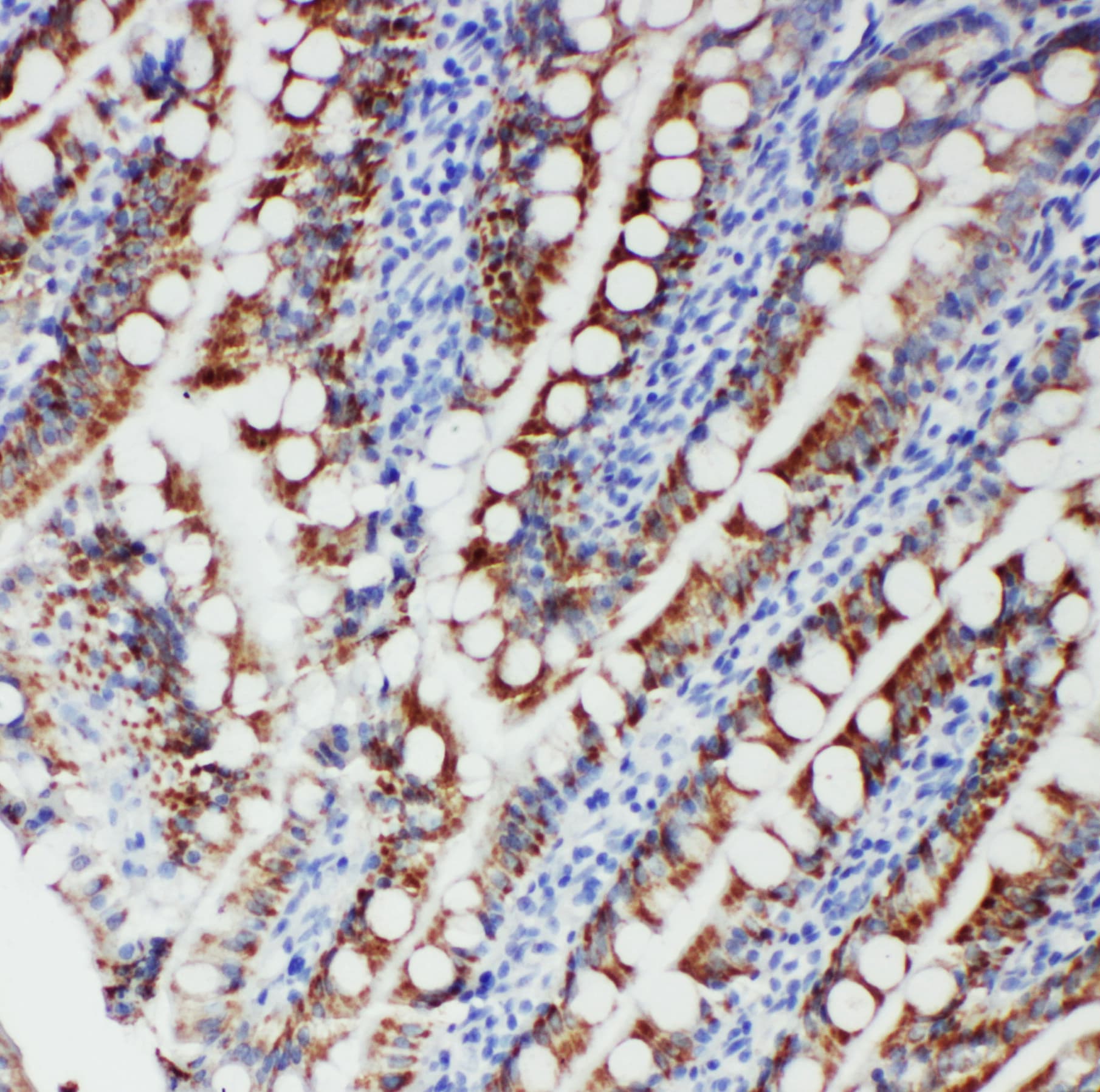 FER Antibody (aa521-536)