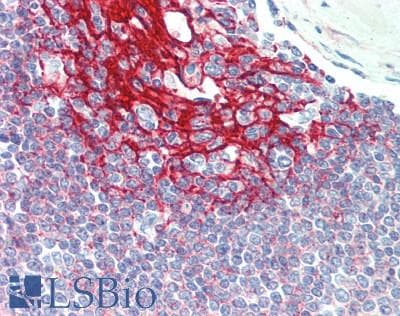 PathPlus™ Monoclonal Mouse anti-Human CR2 / CD21 Antibody (clone Bu33, IHC)