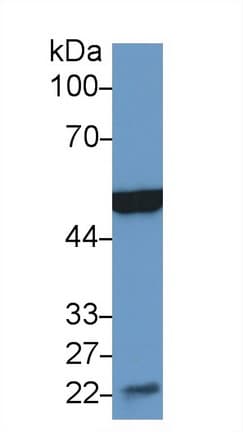 ENO3 / Enolase 3 Antibody (aa3-434)