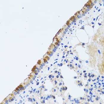 ST3GAL3 / ST3N Antibody