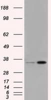 PIM2 / Pim-2 Antibody (clone OTI9A5)