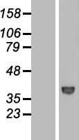 DCAF7 / WDR68 Protein (Over-Expression Lysate Myc-DDK (Flag))