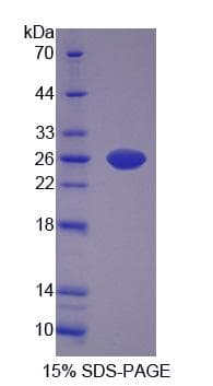 Mouse CARNS1 Protein (Recombinant His-S)