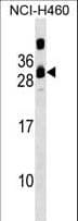 Polyclonal Rabbit anti-Human CIB3 Antibody (aa8-34, WB)